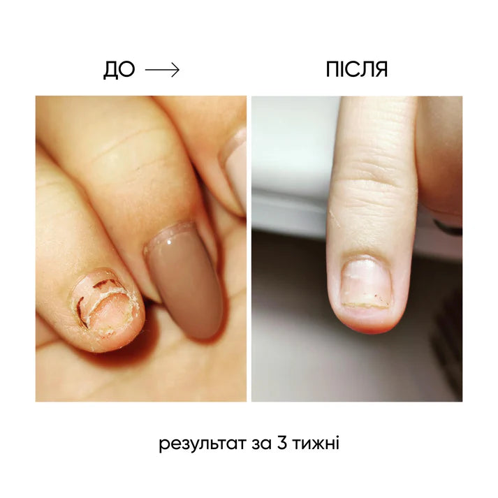 NAILSOFTHEDAY ONISTOP – Aceite regenerador, 15 ml