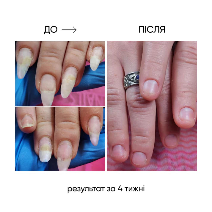 NAILSOFTHEDAY ONISTOP – Aceite regenerador, 15 ml