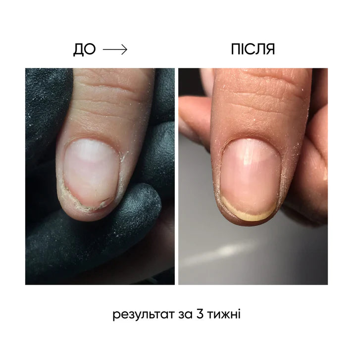 NAILSOFTHEDAY ONISTOP – Aceite regenerador, 15 ml