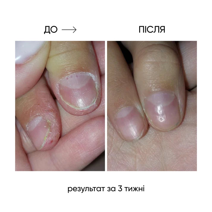 NAILSOFTHEDAY ONISTOP – Aceite regenerador, 15 ml