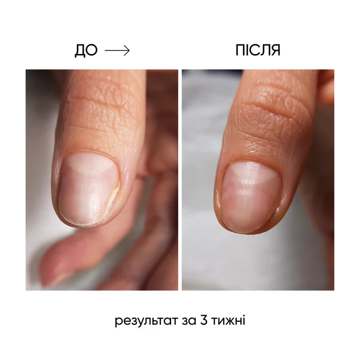 NAILSOFTHEDAY ONISTOP – Aceite regenerador, 15 ml