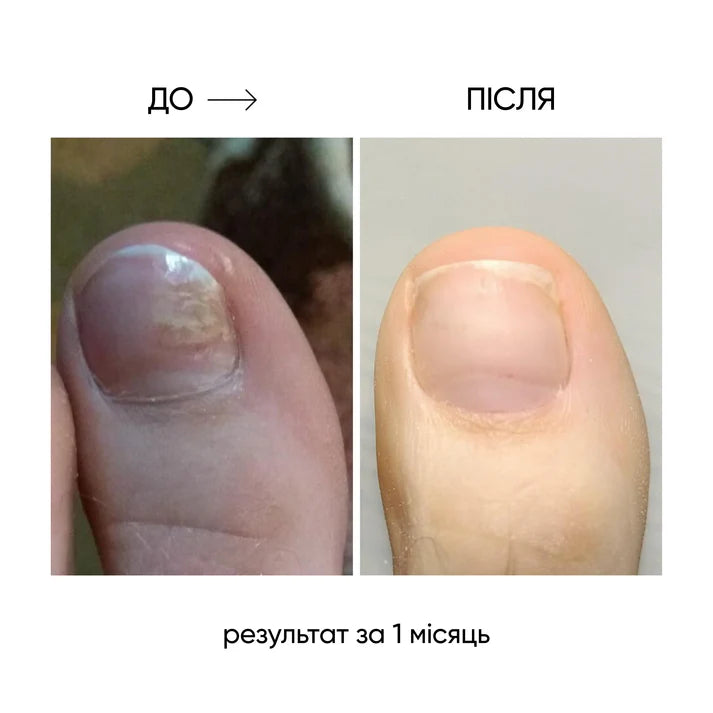 NAILSOFTHEDAY ONISTOP – Aceite regenerador, 15 ml