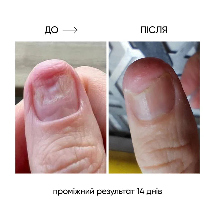 NAILSOFTHEDAY ONISTOP – Aceite regenerador, 15 ml